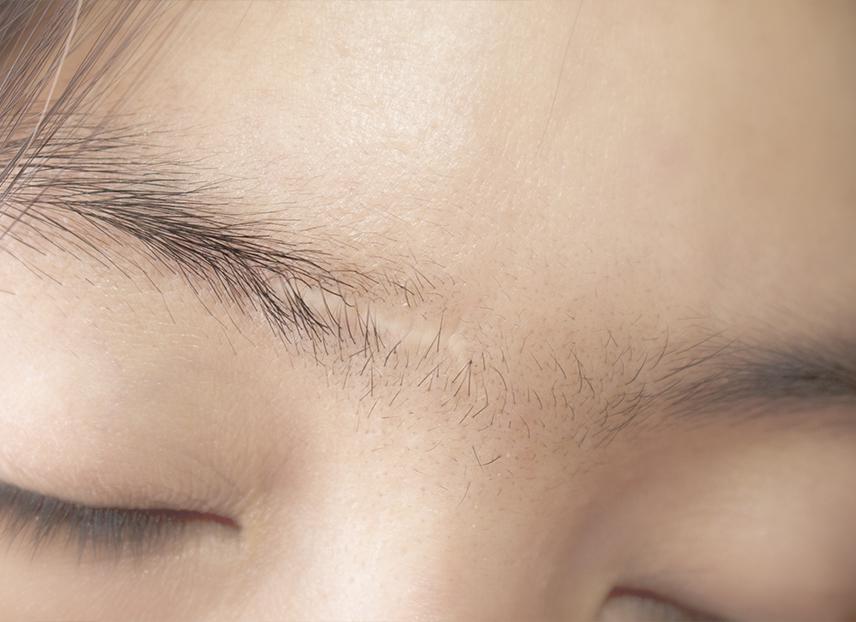 Cách ngụy trang sẹo lông mày bằng cách trang điểm. Hướng dẫn từng bước